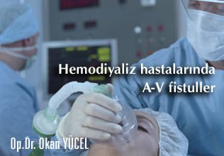 Hemodiyaliz hastalarında a-v fistuller