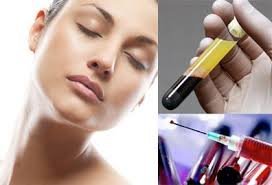 Prp plasma therapy- natural way of rejuvenation 3 9443 |