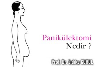 Panikülektomi nedir ? herkes için hafifleme
