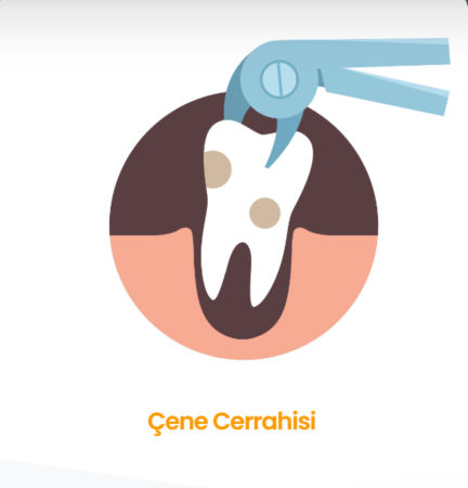 Çene cerrahisi