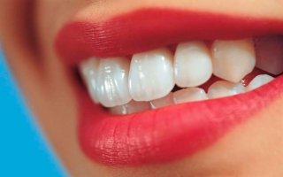 Diş ağartmada  (bleaching)  güncel bilgiler