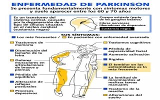 Parkinson hastalığı titreme yurume bozukluğu