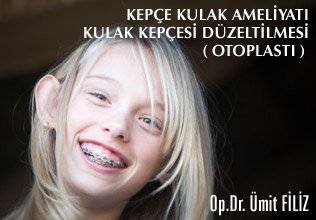Kepçe kulak ameliyatı ( otoplasti )