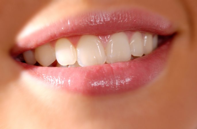 Reflü, diş çürüklerinden ağız kokusuna kadar pek çok sorunun başrol oyuncusu