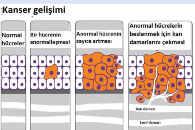 Kanser nedir