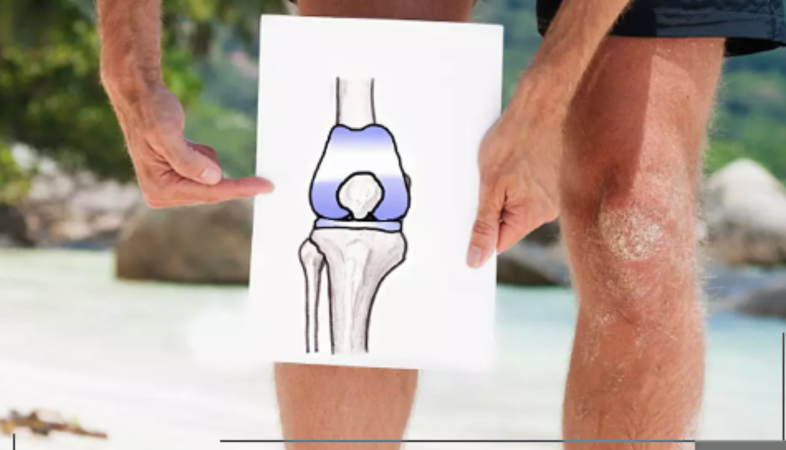 Diz protez operasyonu sonrası foot core egzersizlerinin fonksiyon üzerine etkisi