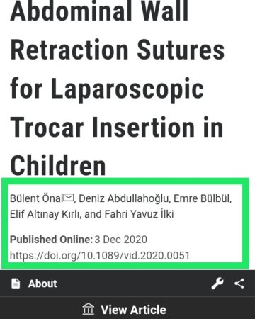 Abdominal wall retraction sutures for laparoscopic trocar ınsertion in children