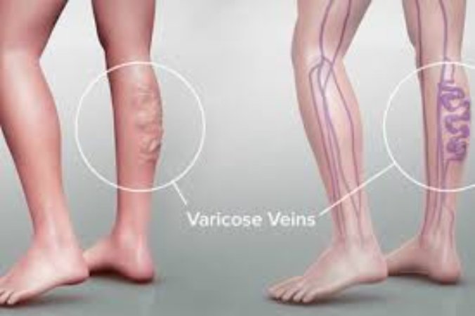Varisin yaptığımız işle ya da meslekle ilgisi var mıdır?