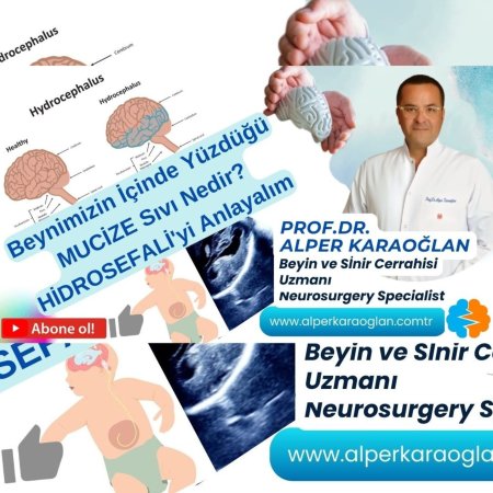 Beynimizin içinde yüzdüğü mucize sıvı nedir? | hidrosefali’yi anlayalım