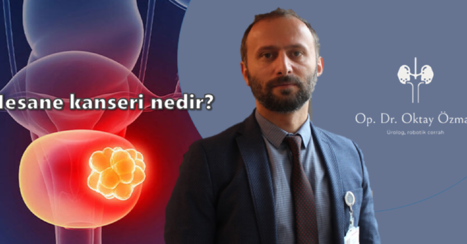 Mesane kanseri nedir? Online Randevu