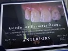 Dt. Gözdenur Kırmacı Özcan Diş Hekimi sertifikası