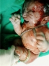 Uzm. Dr. Burhan Çetin Kadın Hastalıkları ve Doğum