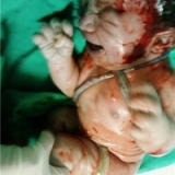 Uzm. Dr. Burhan Çetin