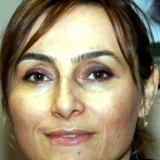 Op. Dr. Aysun  Baltacı