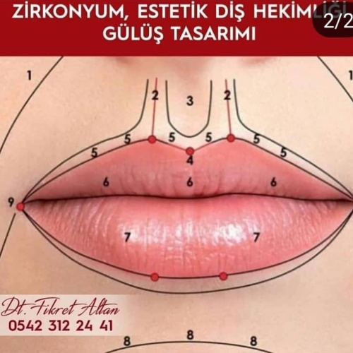 1793407