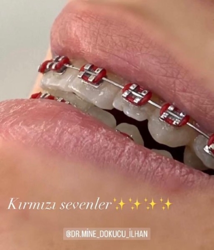 1686130
