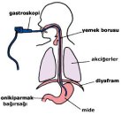 Gastroskopi