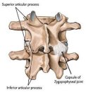 Priformis sendromu bel fıtıgı ile karıştıralabilir.
