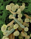 Kandida mantarı (candida albicans) sindirim rahatsızlıkları, dikkat eksikliği, fazla kilo ve depresyon nedenidir.
