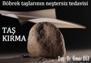 Taş kırma (eswl) - böbrek taşlarının neştersiz tedavisi