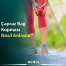 Çapraz bağ kopması nasıl anlaşılır?