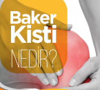 Baker kisti nedir ?