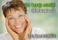 Göz kapağı estetiği (blefaroplasti)