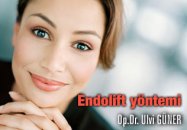 Endolift yöntemi