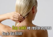 Saç nakli ve restorasyonu