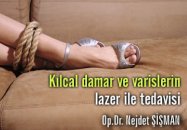 Kılcal damar ve varislerin lazer ile tedavisi