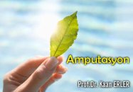 Amputasyon