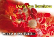 Derin ven trombozu (dvt) hakkında bilmemiz gerekenler