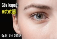 Göz kapağı  estetiği