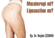 Mezoterapi mi liposuction mı?