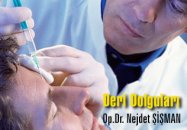 Deri dolguları