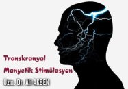 Transkranyal manyetik stimülasyon