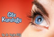 Göz kuruluğu