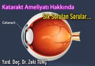 Katarakt ameliyatı hakkında sık sorulan sorular...