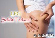 Lpg  selülit tedavisi