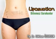 Liposuction hakkında bilinmesi gerekenler