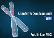 Klinefelter sendromunda tedavi