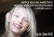 Kepçe kulak ameliyatı ( otoplasti )