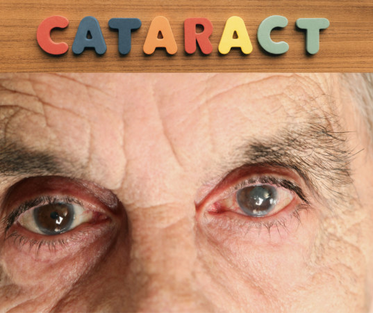 Katarakt