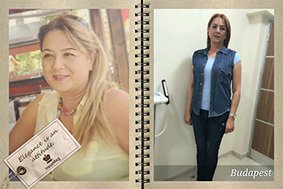 Obezitede cerrahi yöntem öncesi ve sonrası dönem