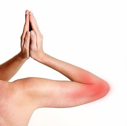 Dirsekte sinir sıkışması (ulnar oluk sendromu)