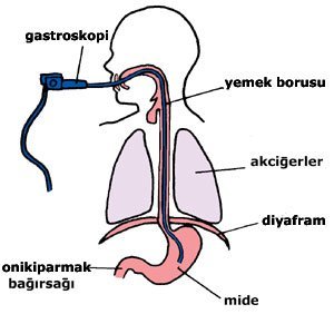 Gastroskopi