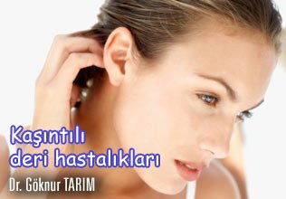 Kaşıntılı deri hastalıkları