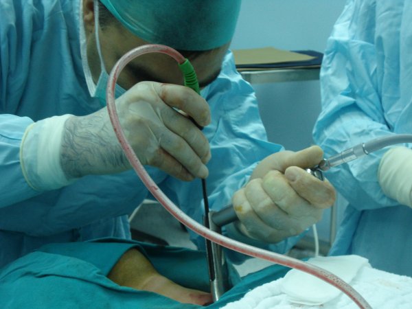 Mediastinal kitleler