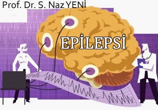 Epilepsi !.