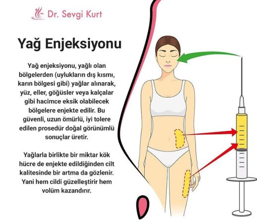 Yağ enjeksiyonu (a fat injection)